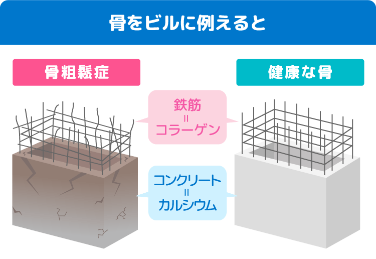骨をビルに例えると、鉄筋＝コラーゲン、コンクリート＝カルシウム